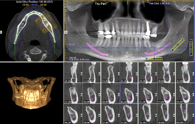 Cone beam computed tomography (CBCT)
