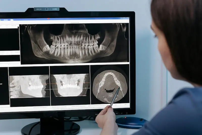 CBCT explanation