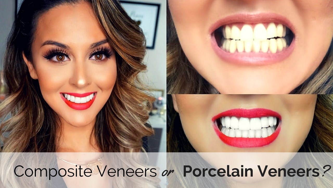 Proper placement of dental veneers can greatly improve your smile and appearance. There are two types of veneers: porcelain and composite. When done correctly, both can give you a beautiful smile, but what are the differences between the two ? And how do you know which one is right for you?
