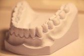 lower dental cast