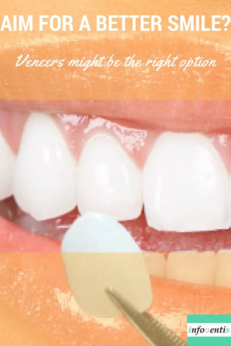 Veneers are an important tool for the cosmetic dentist. A dentist may use one veneer to restore a single tooth that may have been fractured or discolored, or multiple veneers to create a type of makeover. You’ve probably heard about dental veneers but how exactly are they manufactured? Find out about the procedure, indications, care and risks