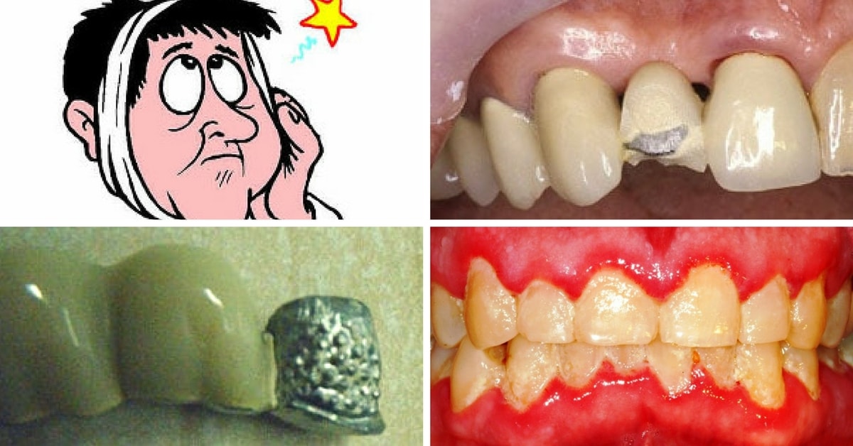 Privirea în gură: dinți sănătoși la câini