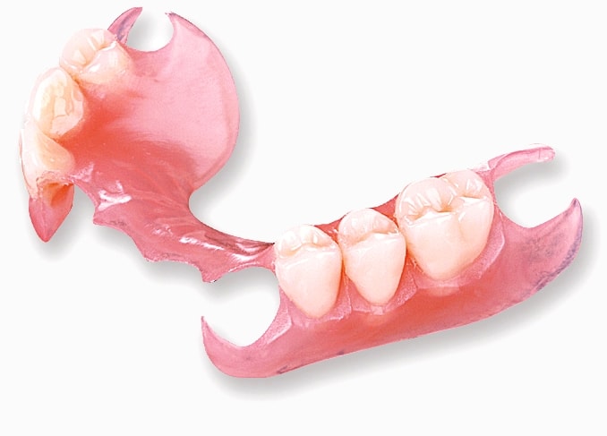 flexible partial denture