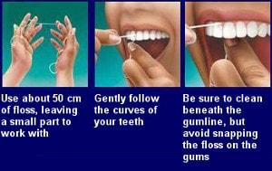 flossing teeth technique