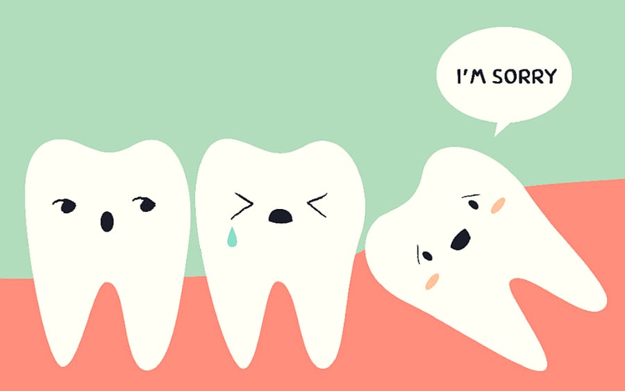 Wisdom Teeth Pain? What You Should Know