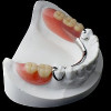 removable partial dentures
