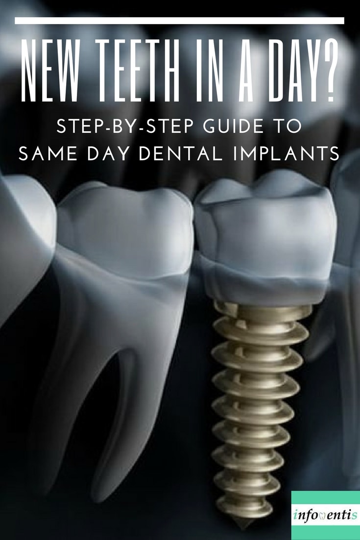 Dental implants are today's state-of-the-art tooth replacement systems. However, the traditional procedure can take up to one year. Nowadays, same day dental implants are becoming far more common: tooth removal, implant placement, and crown attachment are all performed during the same visit. But are immediate implants a viable solution? Check out the risks and benefits of same day dental implants vs traditional implants.