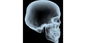 skull radiography