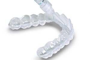 at home teeth whitening procedure step 1