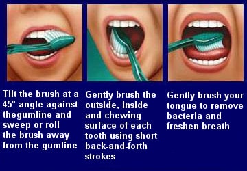 tooth brushing technique