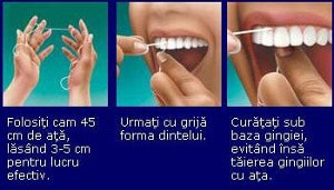 igiena orala : tehnica folosirii atei dentare