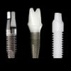 implanturile dentare zirconiu