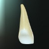 puntea dentara, alegerea dintilor stalpi : incisivul central superior