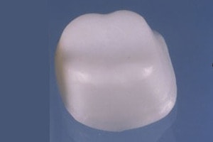 lucrari dentare fixe, materiale : zirconiul