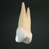 puntea dentara, alegerea dintilor stalpi : primul premolar superior