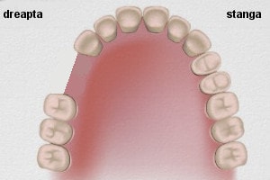 puntea dentara, exemple practice : cazul 1