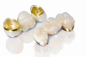 punti dentare metalo ceramice pe aliaj de aur