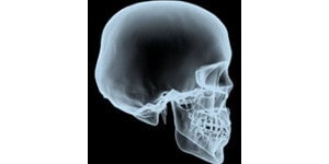 radiografia de craniu