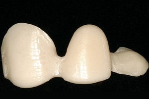 lucrari dentare fixe : schelet de sustinere zirconiu