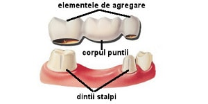 structura punte dentara