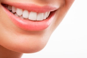 tratamente ortodontice moderne, dupa tratament